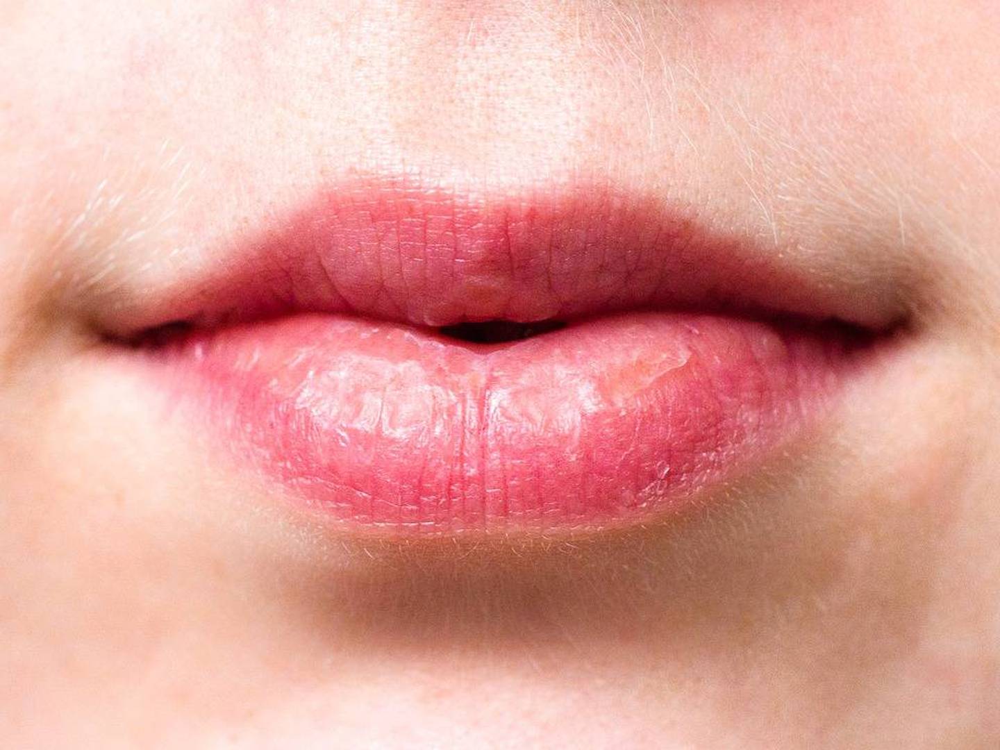 5 remedios caseros para aliviar labios partidos – Activo